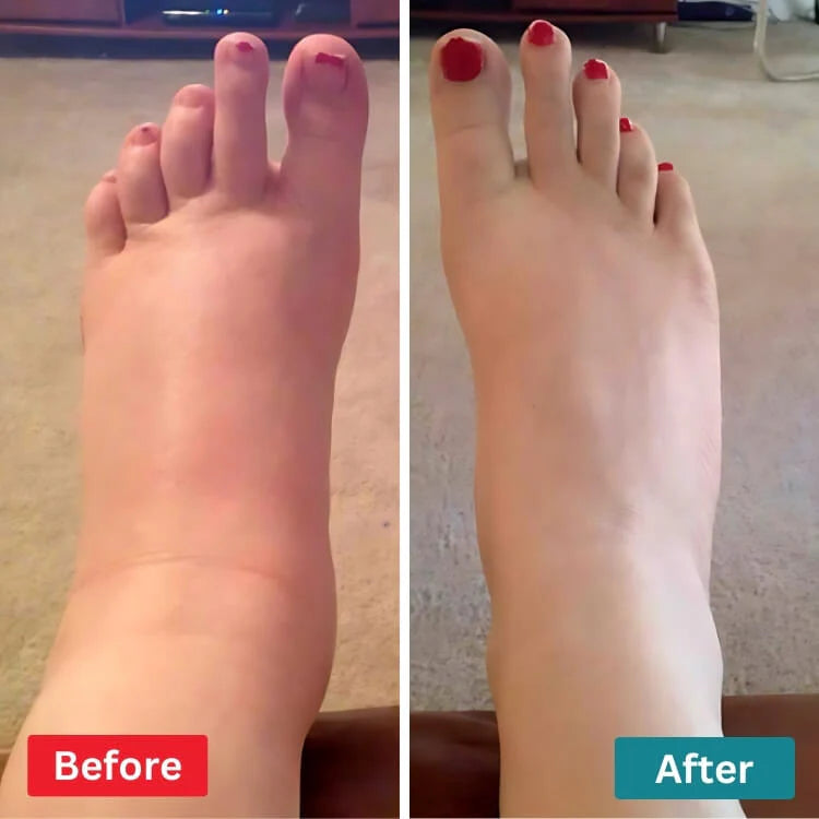FeetRelief — Gentle, drug‑free foot nerve relief you can use at home