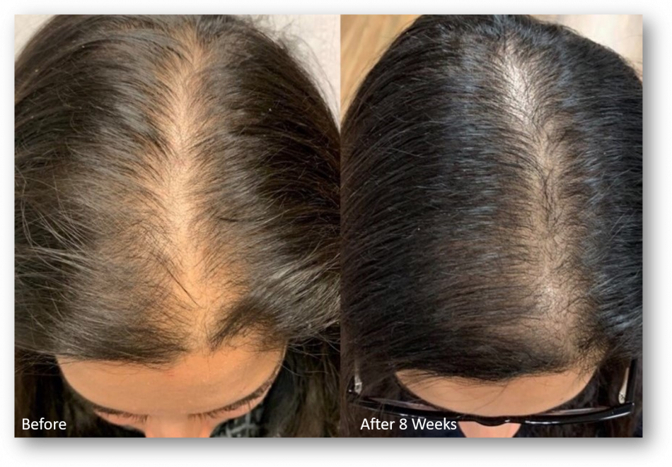 Beautiful Being Batana Rejuvenating Hair Growth Oil