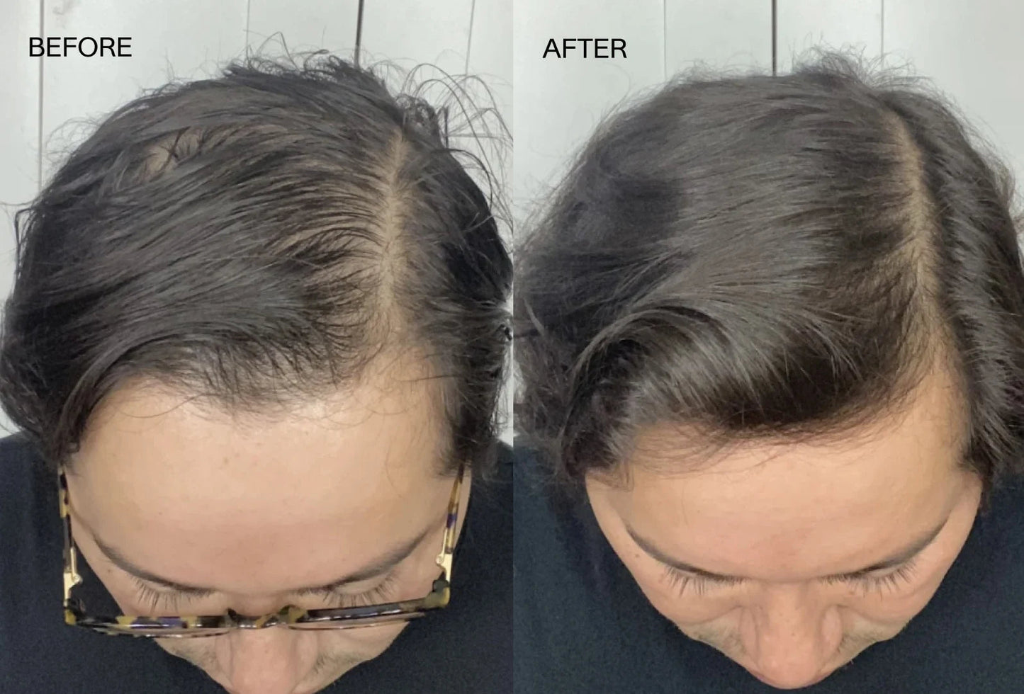 Beautiful Being Batana Rejuvenating Hair Growth Oil