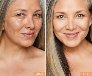 3. Say Hello to Youthful Radiance