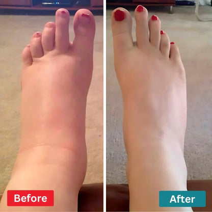 FeetRelief — Gentle, drug‑free foot nerve relief you can use at home