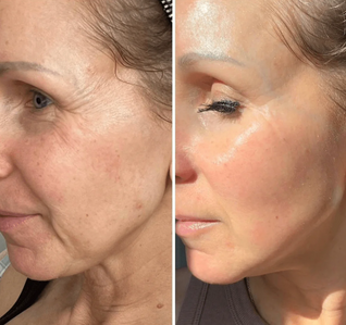 Wake Up Without Your Skin Burning, Stinging, or Feeling “On Edge”